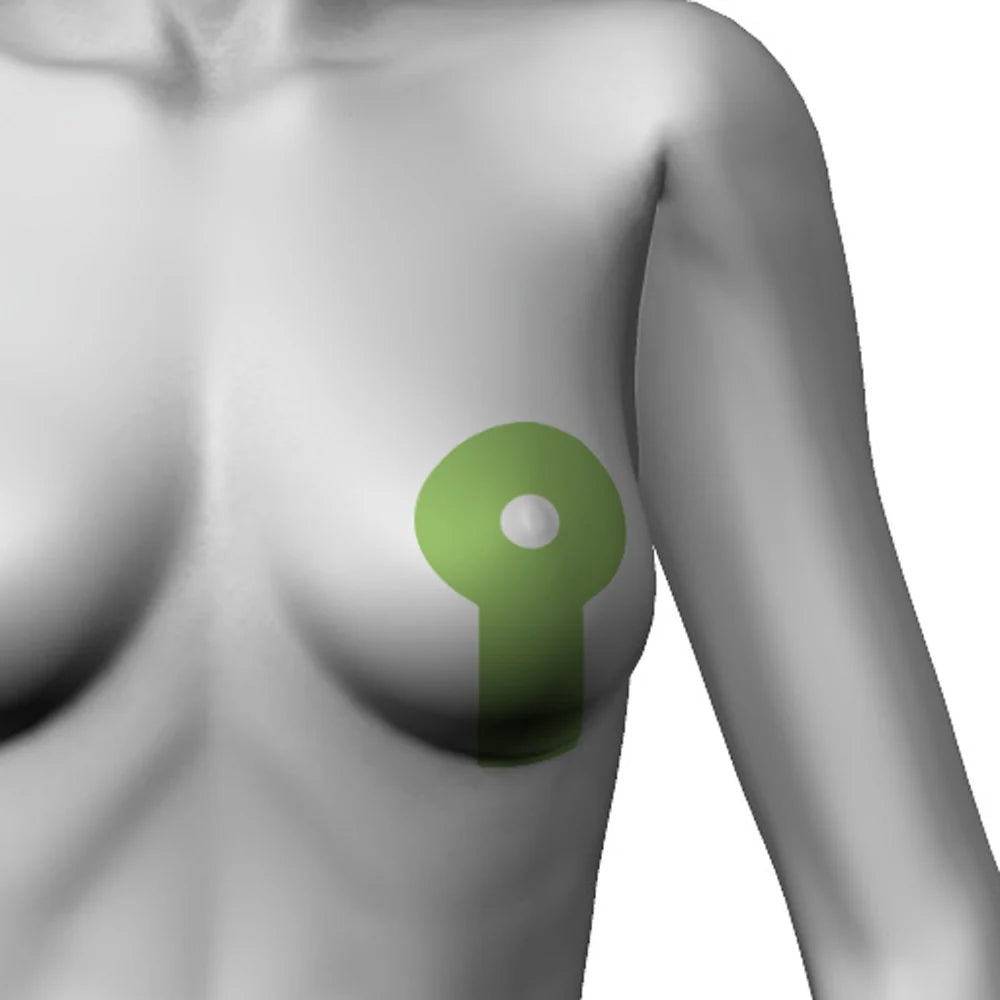 Bandă medicală adezivă silicon pentru tratamentul cicatricilor, forma Lollypop