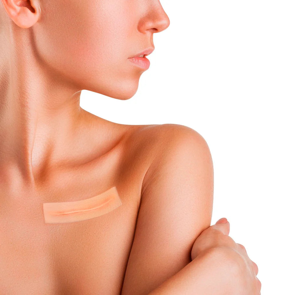 Bandă medicală adezivă silicon pentru tratamentul cicatricilor, 5x20cm